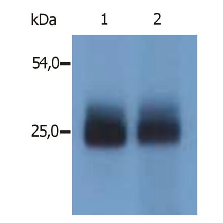 Western Blot - Anti-NTAL Antibody (A85803) - Antibodies.com