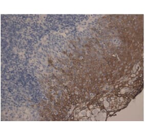 IHC - Anti-Cytokeratin 10 + 13 Antibody [DE-K13] (A85818)