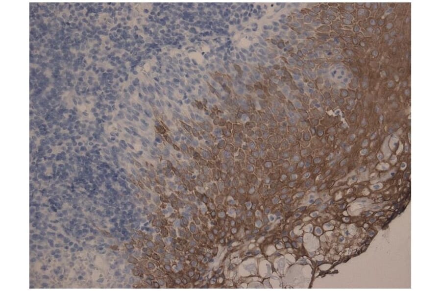 IHC - Anti-Cytokeratin 10 + 13 Antibody [DE-K13] (A85818)