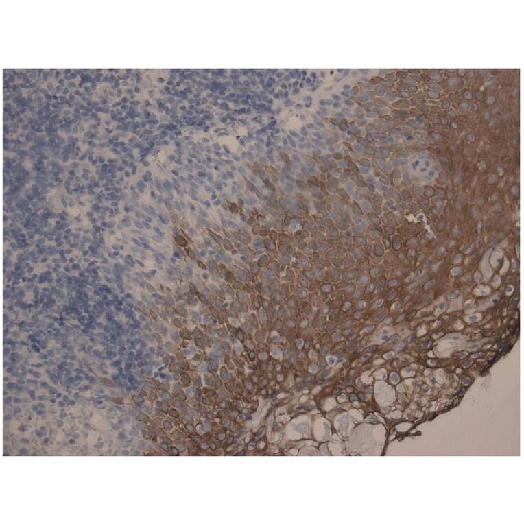 IHC - Anti-Cytokeratin 10 + 13 Antibody [DE-K13] (A85818)
