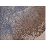 IHC - Anti-Cytokeratin 10 + 13 Antibody [DE-K13] (A85818)