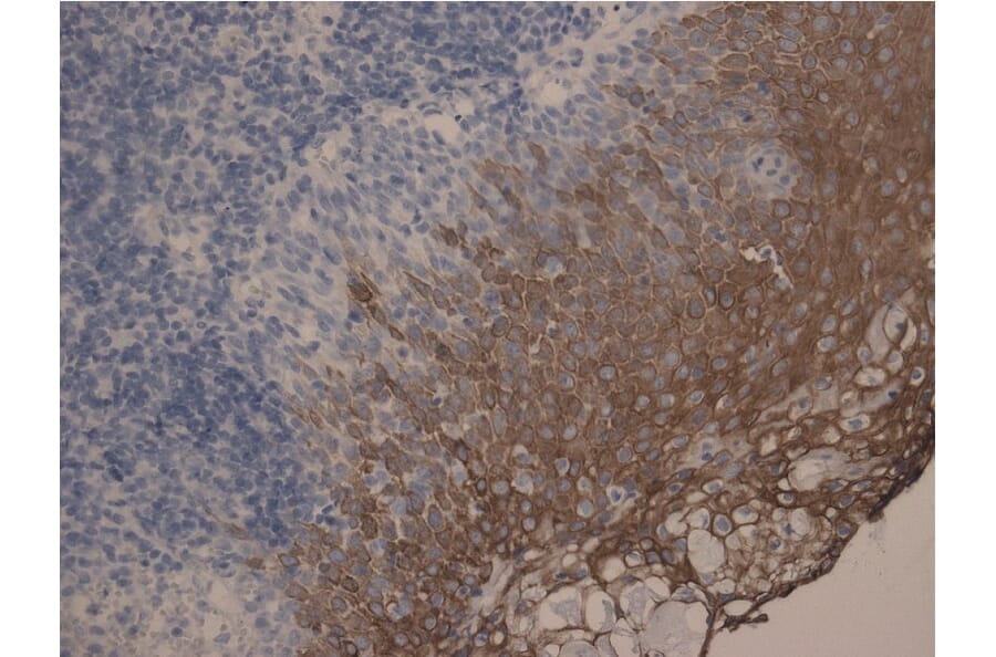 Immunohistochemistry - Anti-Cytokeratin 10 + 13 Antibody [DE-K13] (A85814) - Antibodies.com