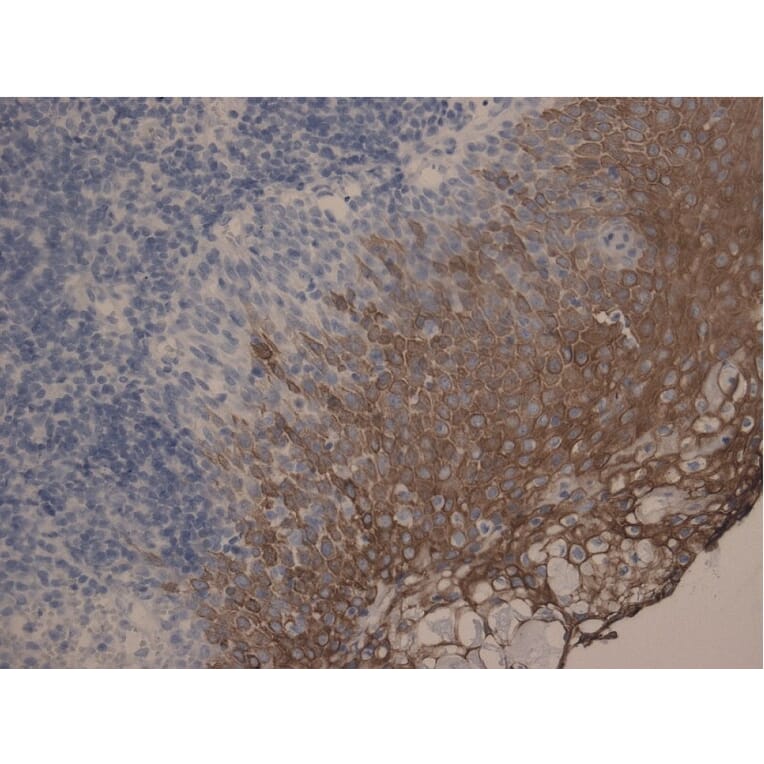Immunohistochemistry - Anti-Cytokeratin 10 + 13 Antibody [DE-K13] (A85814) - Antibodies.com