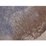 Immunohistochemistry - Anti-Cytokeratin 10 + 13 Antibody [DE-K13] (A85814) - Antibodies.com