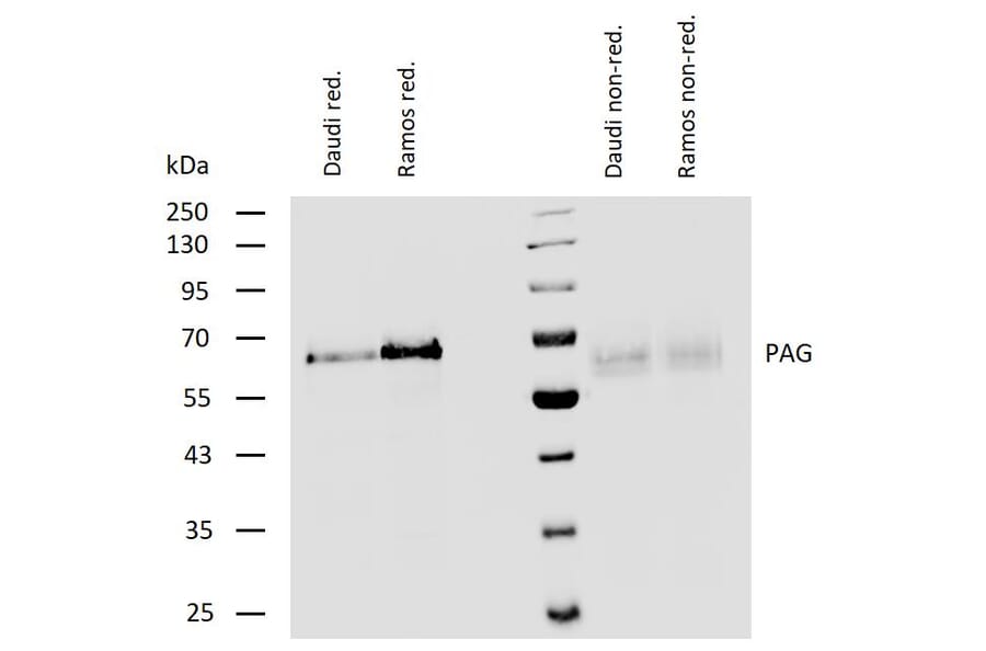WB - Anti-PAG1 Antibody (A85825)