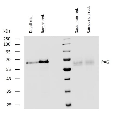 WB - Anti-PAG1 Antibody (A85825)