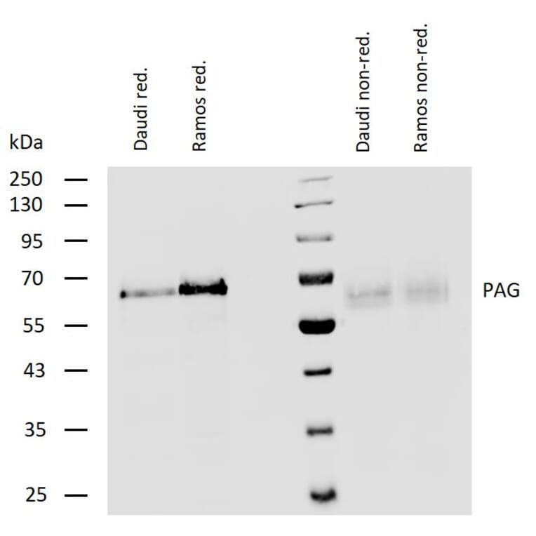 WB - Anti-PAG1 Antibody (A85825)