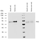 WB - Anti-PAG1 Antibody (A85825)