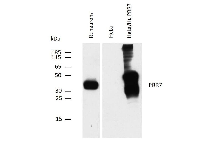 WB - Anti-PRR7 Antibody [TRAP3/10] (A85830)