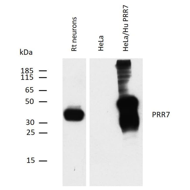 WB - Anti-PRR7 Antibody [TRAP3/10] (A85830)
