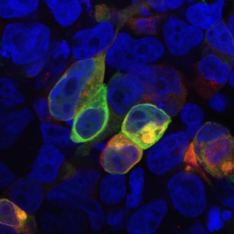 Immunocytochemistry - Anti-PRR7 Antibody [TRAP3/10] (A85830) - Antibodies.com