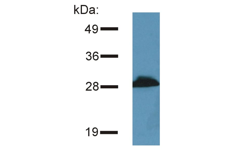 Western Blot - Anti-PRR7 Antibody [TRAP3/10] (A85827) - Antibodies.com