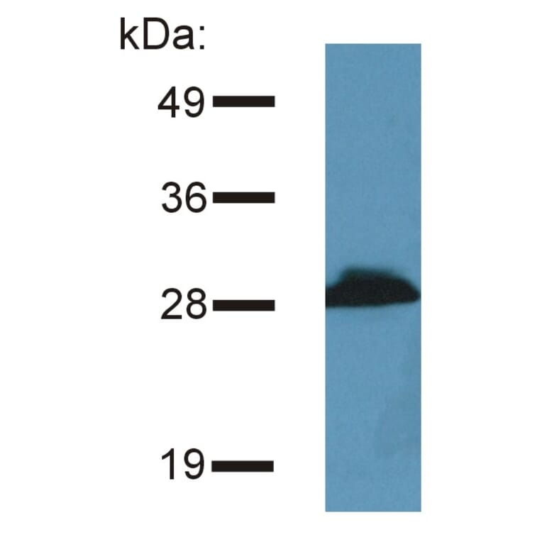 Western Blot - Anti-PRR7 Antibody [TRAP3/10] (A85827) - Antibodies.com