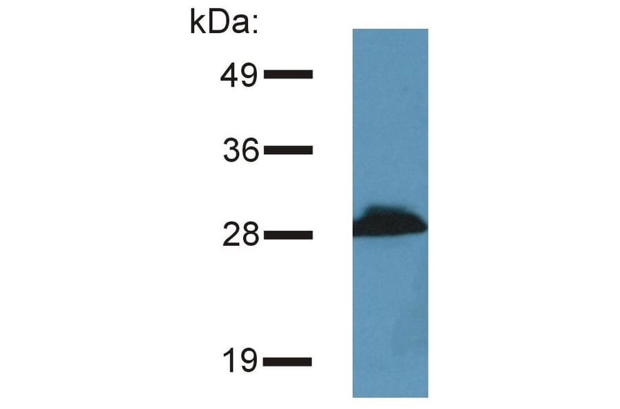 WB - Anti-PRR7 Antibody [TRAP3/10] (A85830)