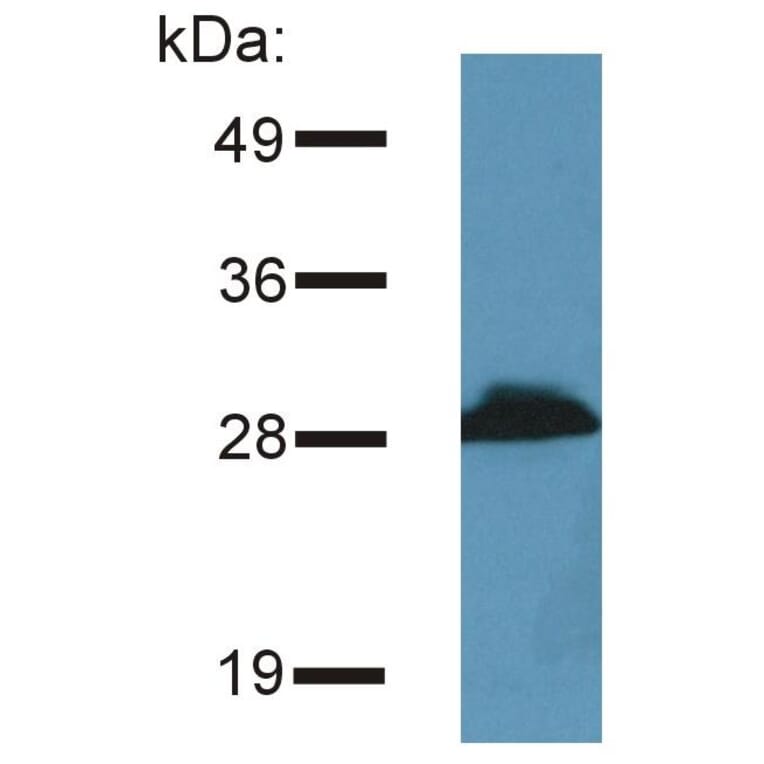 WB - Anti-PRR7 Antibody [TRAP3/10] (A85830)