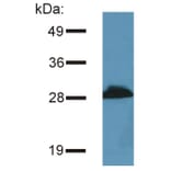 WB - Anti-PRR7 Antibody [TRAP3/10] (A85830)