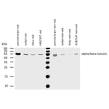 WB - Anti-alpha Tubulin + beta Tubulin Antibody [TU-08] (A85833)