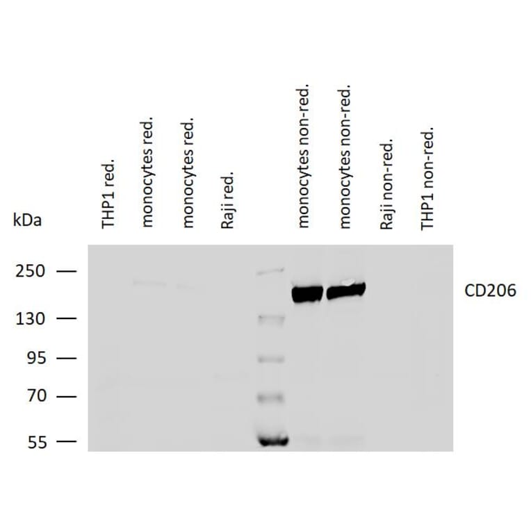 WB - Anti-Mannose Receptor Antibody [15-2] (A85836)