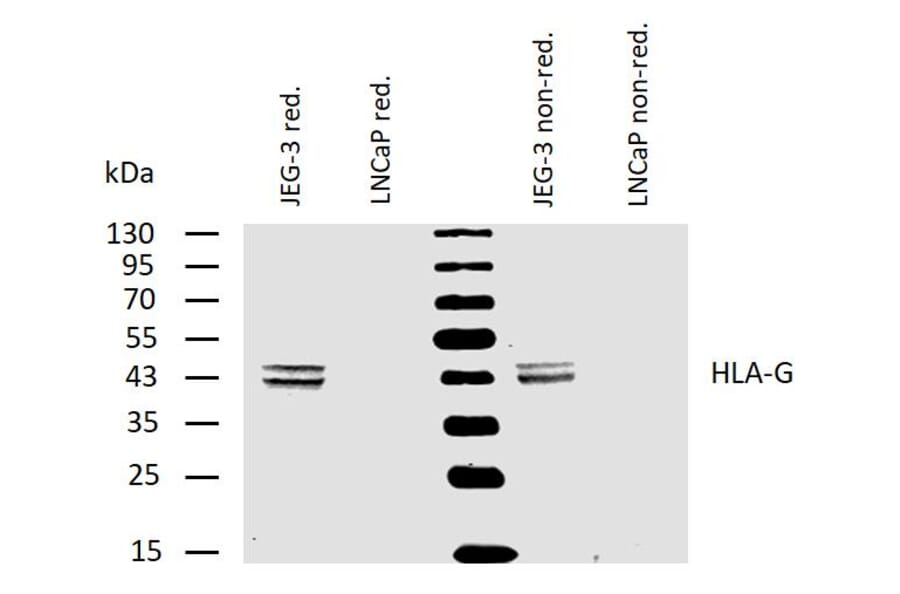 WB - Anti-HLA G Antibody [MEM-G/4] (A85844)