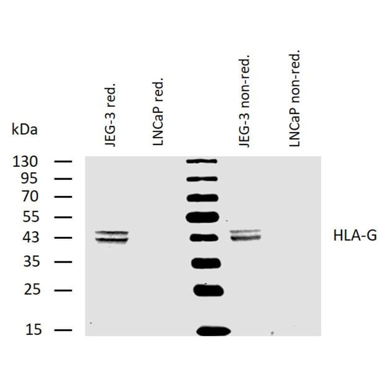 WB - Anti-HLA G Antibody [MEM-G/4] (A85844)