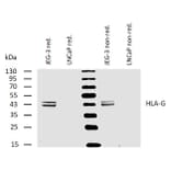WB - Anti-HLA G Antibody [MEM-G/4] (A85844)