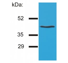 Western Blot - Anti-HLA G Antibody [MEM-G/4] (A85843) - Antibodies.com