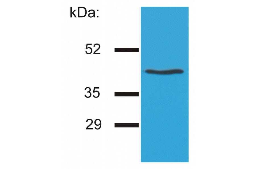 AntiHLA G Antibody [MEMG/4] (A85844)