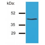 Western Blot - Anti-HLA G Antibody [MEM-G/4] (A85843) - Antibodies.com
