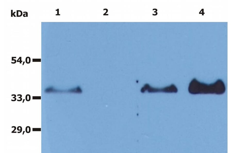 Immunoprecipitation - Anti-CD20 Antibody [MEM-97] - BSA and Azide free (A85848) - Antibodies.com