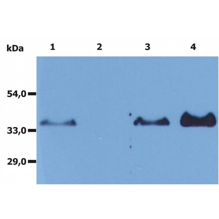 Immunoprecipitation - Anti-CD20 Antibody [MEM-97] - BSA and Azide free (A85848) - Antibodies.com