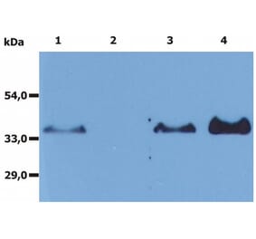 IP - Anti-CD20 Antibody [MEM-97] (A85851)