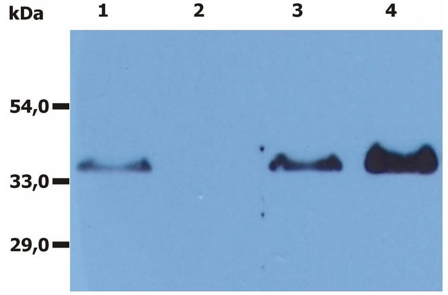 IP - Anti-CD20 Antibody [MEM-97] (A85851)