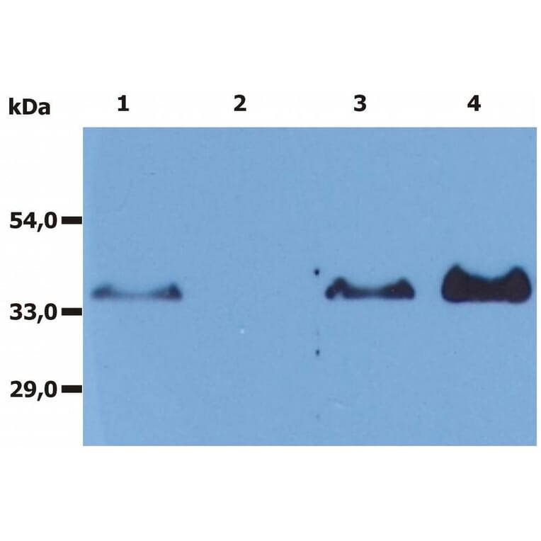 IP - Anti-CD20 Antibody [MEM-97] (A85851)