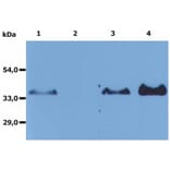 IP - Anti-CD20 Antibody [MEM-97] (A85851)