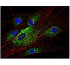 ICC - Anti-Syk Antibody [SYK-01] (A85858)