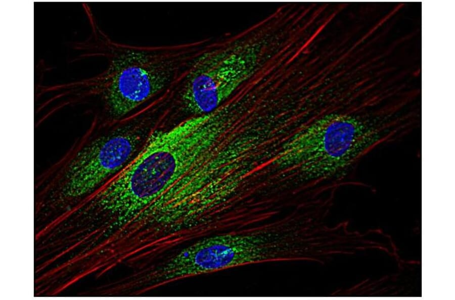 ICC - Anti-Syk Antibody [SYK-01] (A85858)
