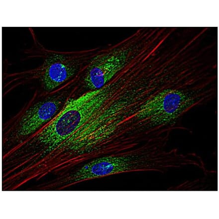 ICC - Anti-Syk Antibody [SYK-01] (A85858)
