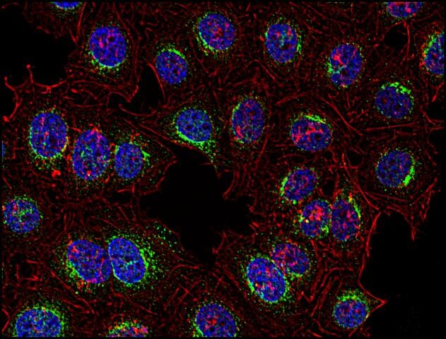 Anti-Syk Antibody [SYK-01] (A85858) | Antibodies.com