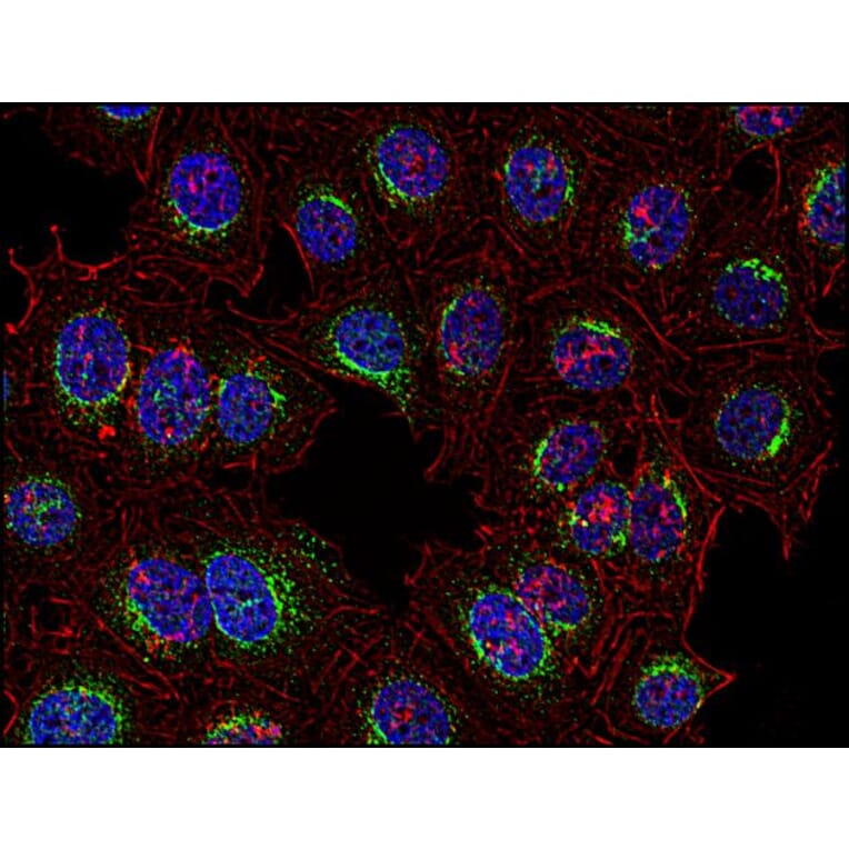 Immunocytochemistry - Anti-SYK Antibody [SYK-01] (A85856) - Antibodies.com