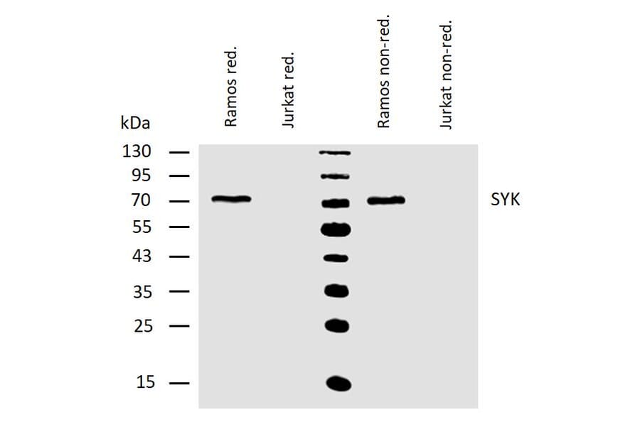 WB - Anti-Syk Antibody [SYK-01] (A85858)
