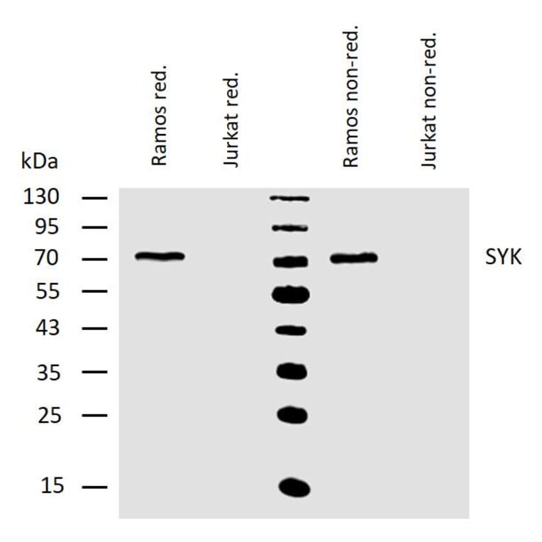 WB - Anti-Syk Antibody [SYK-01] (A85858)