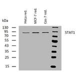 WB - Anti-STAT1 Antibody [SM1] (A85870)
