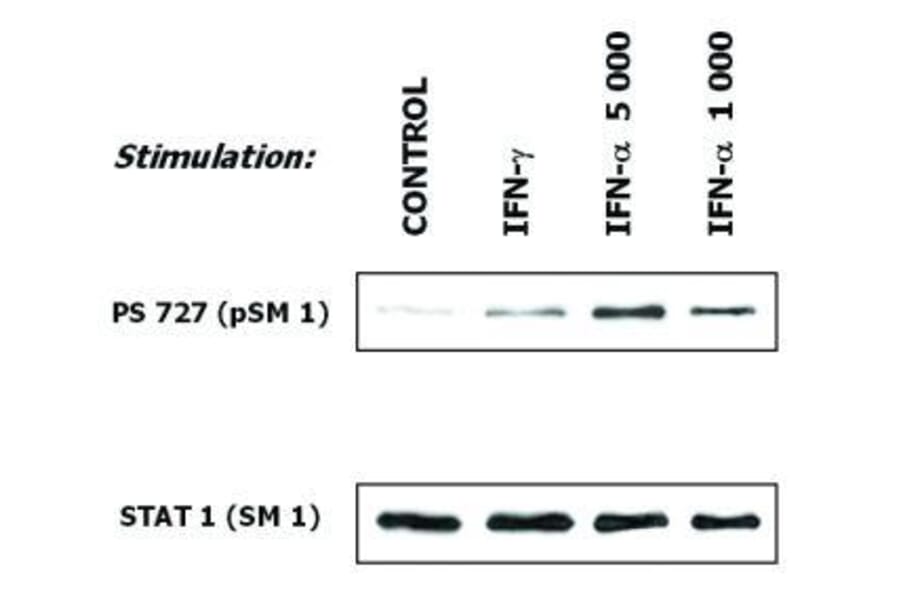 WB - Anti-STAT1 Antibody [SM1] (A85870)