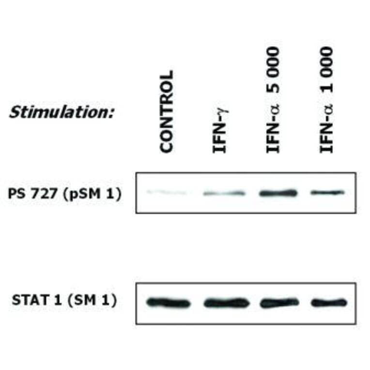 WB - Anti-STAT1 Antibody [SM1] (A85870)