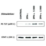WB - Anti-STAT1 Antibody [SM1] (A85870)