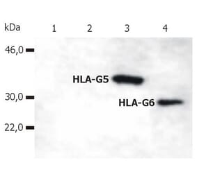 WB - Anti-HLA G Antibody [5A6G7] (A85877)
