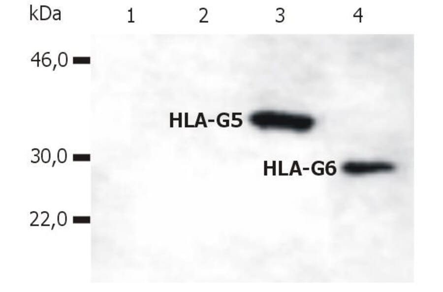 WB - Anti-HLA G Antibody [5A6G7] (A85877)