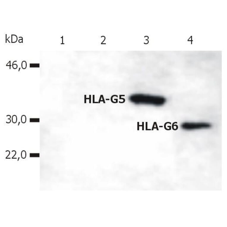 WB - Anti-HLA G Antibody [5A6G7] (A85877)