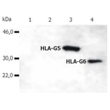 WB - Anti-HLA G Antibody [5A6G7] (A85877)