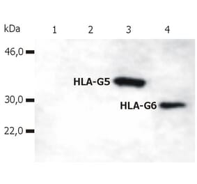 Western Blot - Anti-HLA G Antibody [5A6G7] (A85876) - Antibodies.com